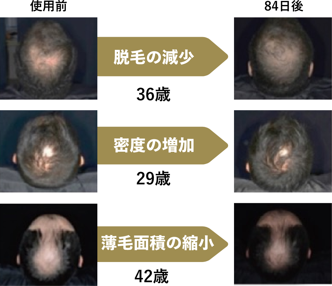 使用前 → 84日後