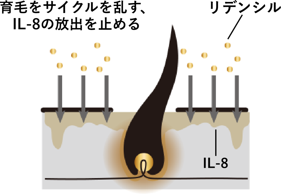 育毛をサイクルを乱す、IL-8の放出を止める